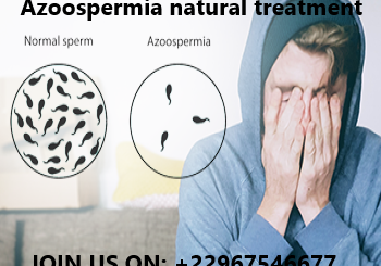 Azoospermia natural treatment